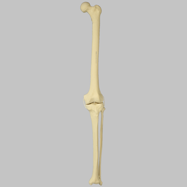 Knee with Fibula and Four Non-Stretch Ligaments, Full Length