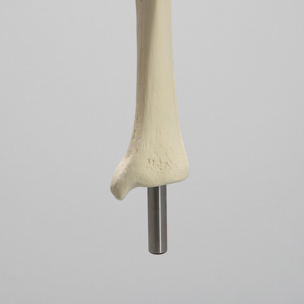 Knee Replacement with Tibia and Femur for #1301-169 and 1301-169-1