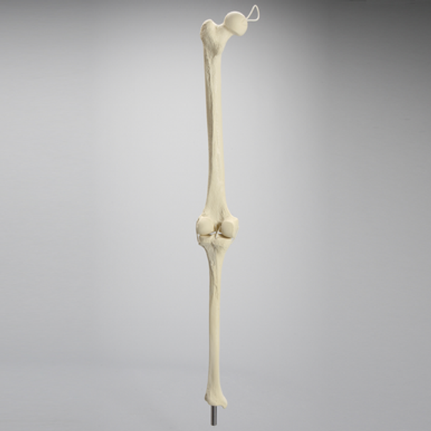 Knee Replacement with Tibia and Femur for #1301-169 and 1301-169-1