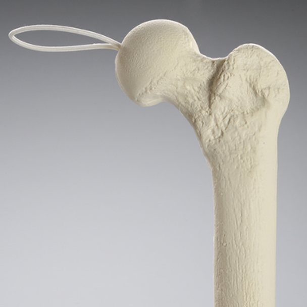 Knee Replacement for Hip Assembly #1301-160