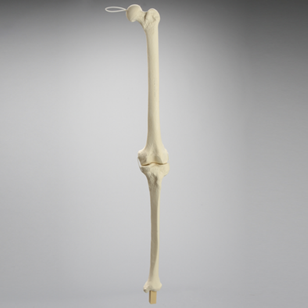 Knee Replacement for Hip Assembly #1301-160