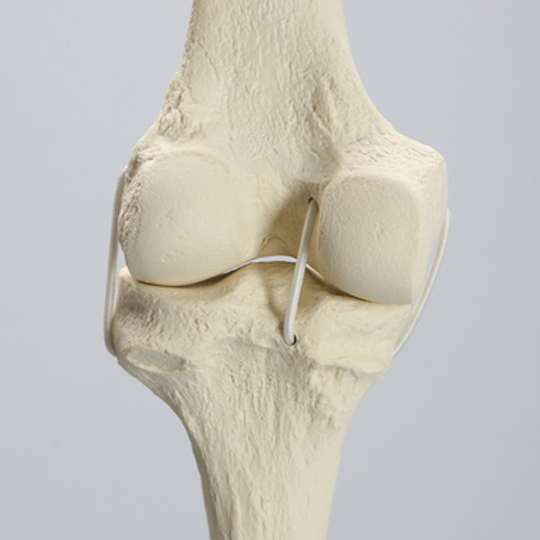 Knee Replacement for Hip Assembly #1301-160