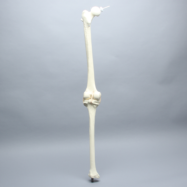 Knee Replacement for Hip Assembly #1301-161