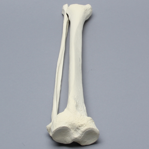 Tibia and Fibula, Left, Large Tibia and Fibula, Left, Large