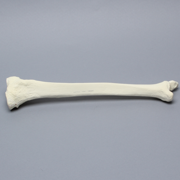 Tibia and Fibula, Left, Large Tibia and Fibula, Left, Large