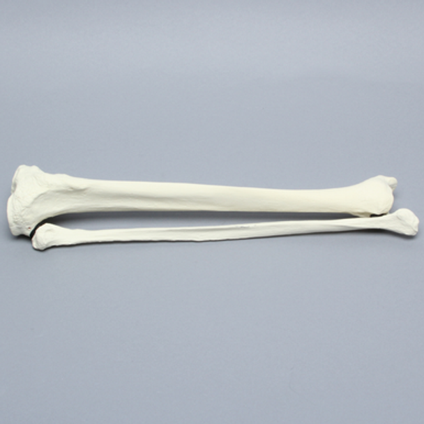 Tibia and Fibula, Right, Large Tibia and Fibula, Right, Large