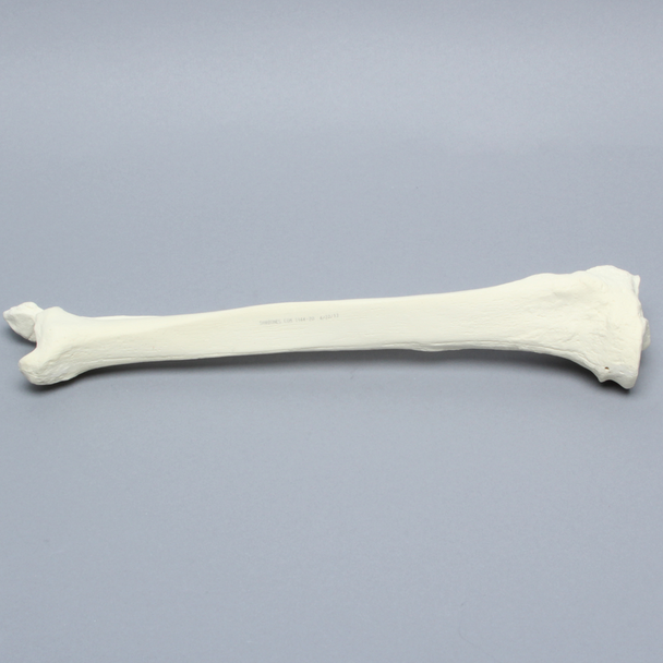 Tibia and Fibula, Right, Large