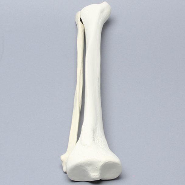 Tibia and Fibula, Foam Cortical, Left
