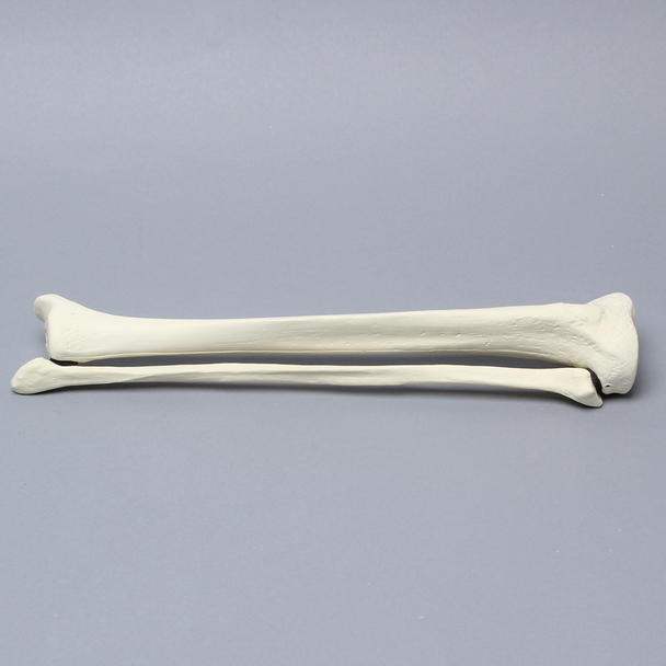 Tibia and Fibula, Solid Foam, Medium