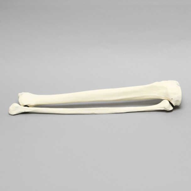 Tibia and Fibula, Solid Foam, Large