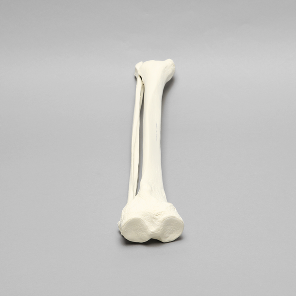 Tibia and Fibula, Solid Foam, Large