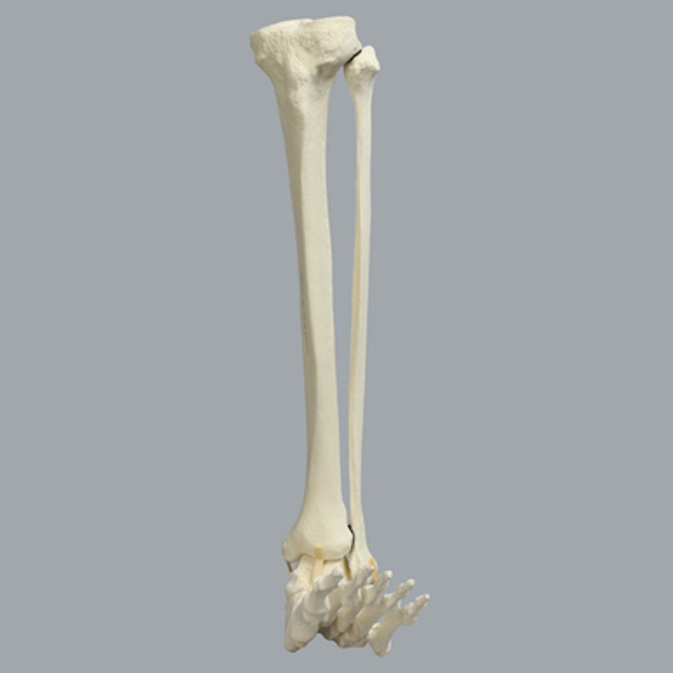 Foot and Ankle with Rocker-Foot Syndrome