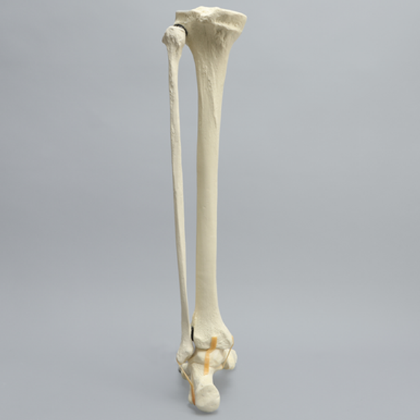 Foot and Ankle, Foam Cortical, Left