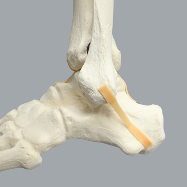 Foot and Ankle, Foam Cortical, Left