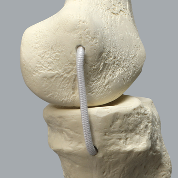 Full Leg with Three Stretch Cord Knee Ligaments