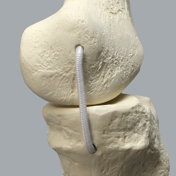 Full Leg with Three Stretch Cord Knee Ligaments