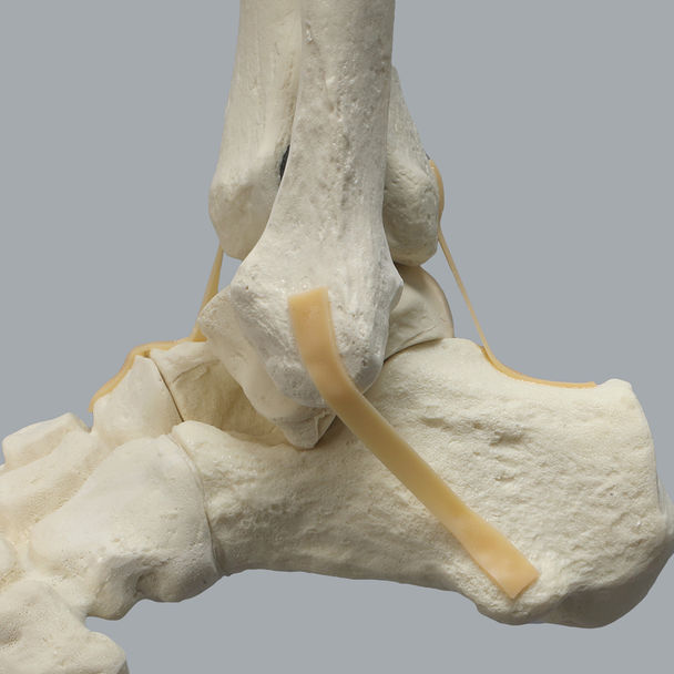 Full Leg with Three Stretch Cord Knee Ligaments
