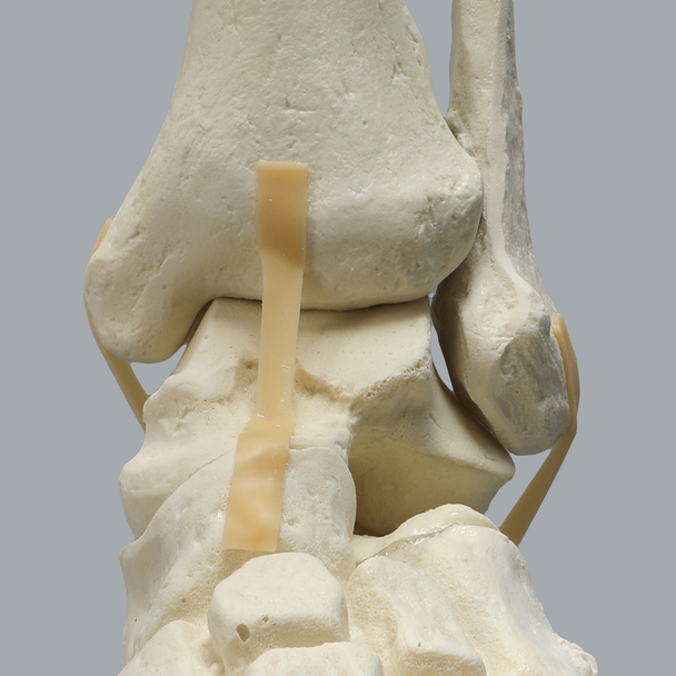 Full Leg with Three Stretch Cord Knee Ligaments