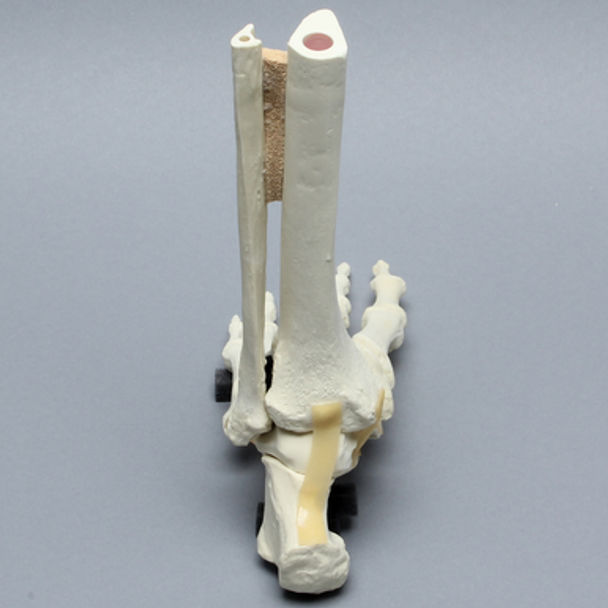 Foot and Ankle, Articulating, Foam Cortical
