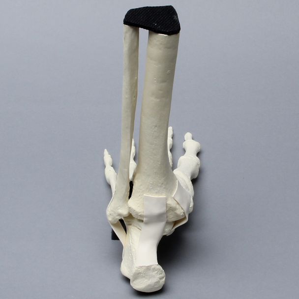 Foot and Ankle with Non-Stretch Ligaments