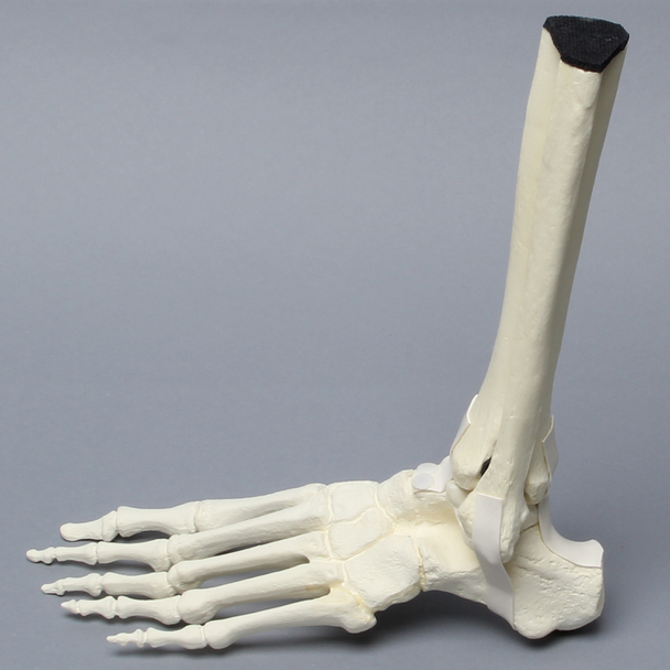 Foot and Ankle with Non-Stretch Ligaments