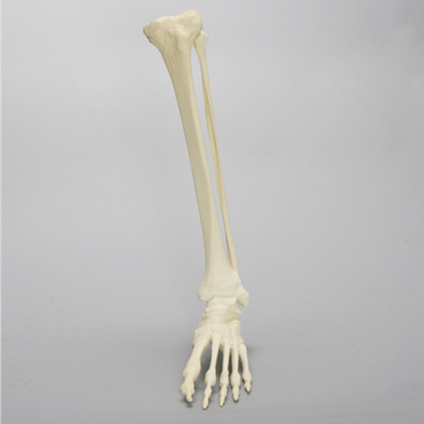 Foot and Ankle with Multiple Deformities