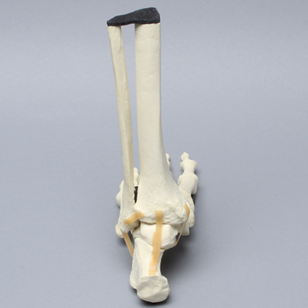 Foot and Ankle, Articulating, Solid Foam