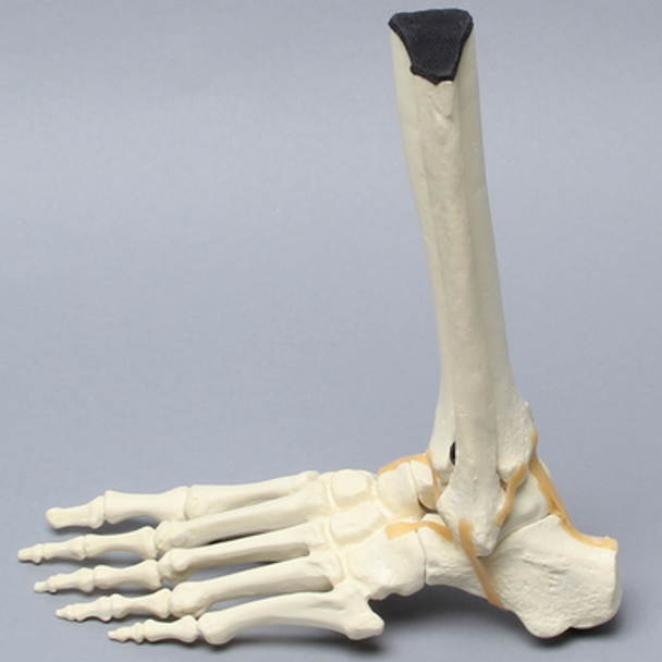 Foot and Ankle, Articulating, Solid Foam