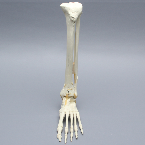 Foot and Ankle with Tibial Four-Part Pilon and Fibular Oblique Fractures