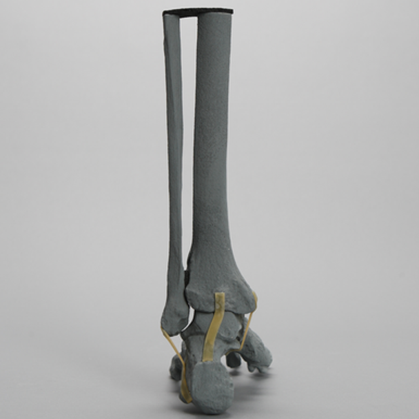 Foot and Ankle, Radiopaque