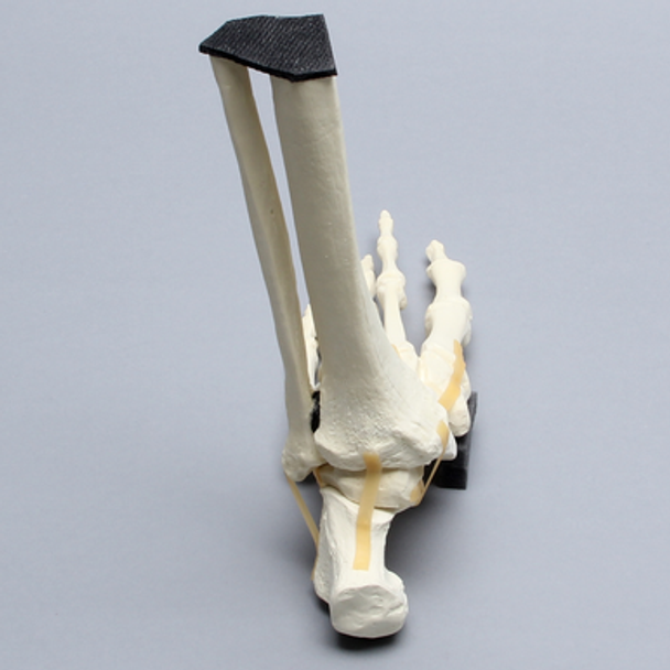 Foot and Ankle with Lisfranc and Cuboid Fractures