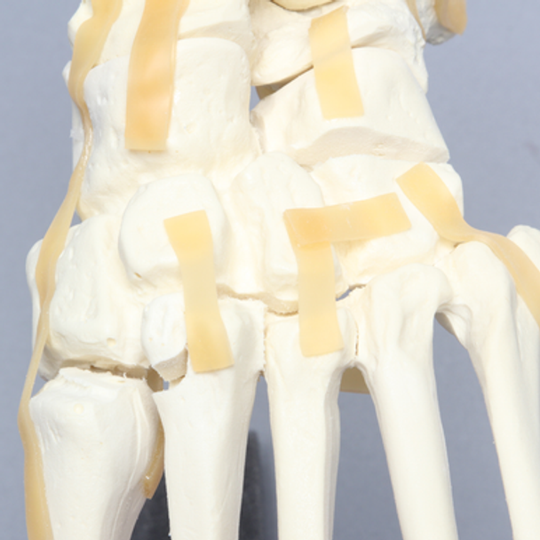 Foot and Ankle with Lisfranc and Cuboid Fractures