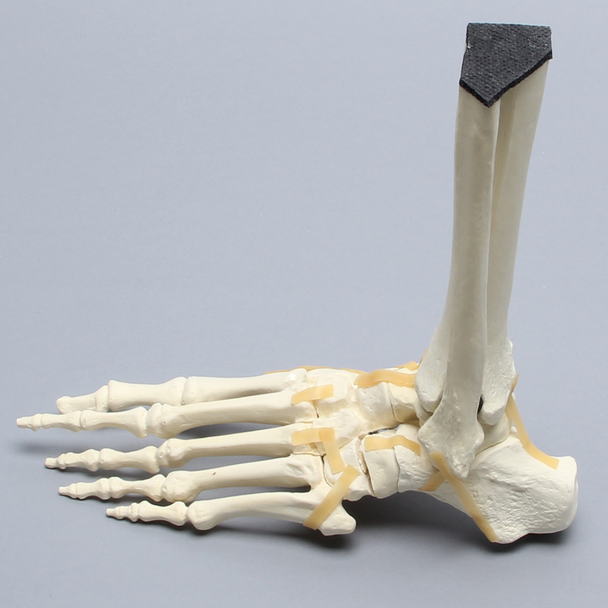 Foot and Ankle with Lisfranc and Cuboid Fractures