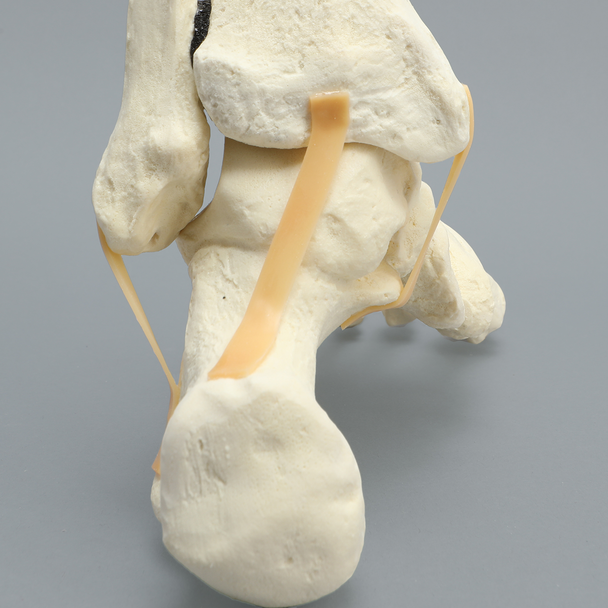 Foot and Ankle with Distal Tibia & Fibula, Solid Foam, Left
