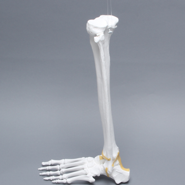 Foot and Ankle, Plastic Cortical, Left