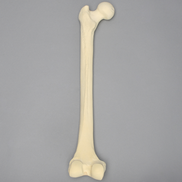 Femur with 16 mm For IM Nail