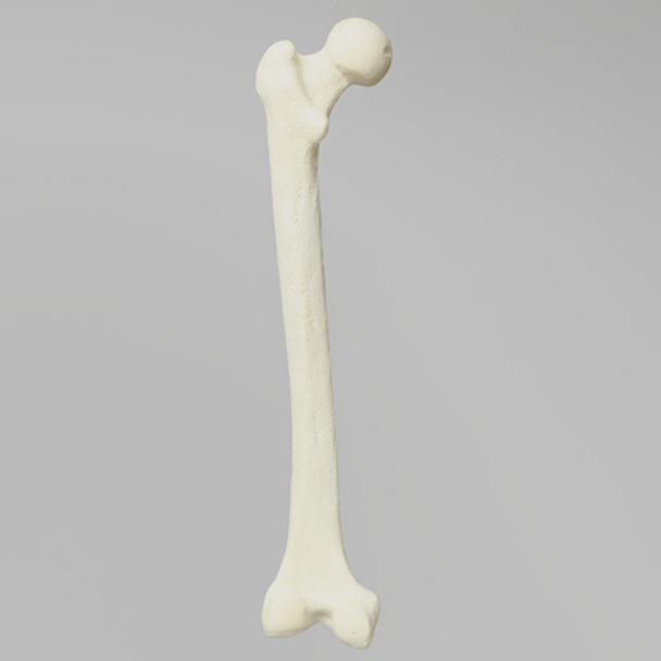 Femur with 12 mm Canal and Distal Plug
