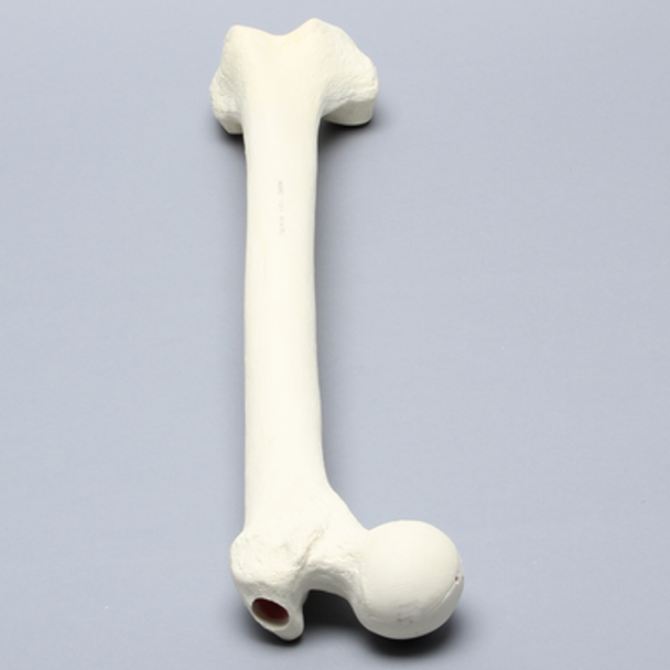 Femur with 17 mm Trochanteric Entry Site For IM Nail
