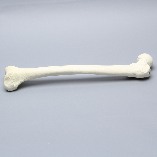 Femur with 17 mm Trochanteric Entry Site For IM Nail