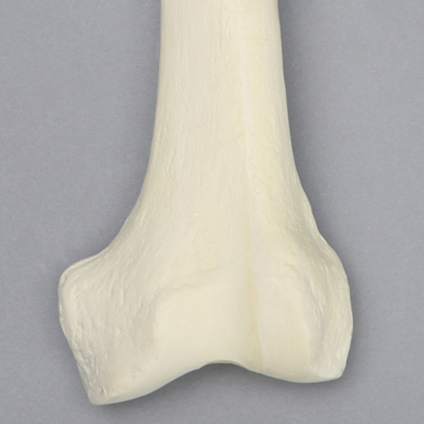 Femur with 9 mm Canal, Foam Cortical, Left