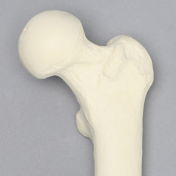 Femur with 9 mm Canal, Foam Cortical, Left