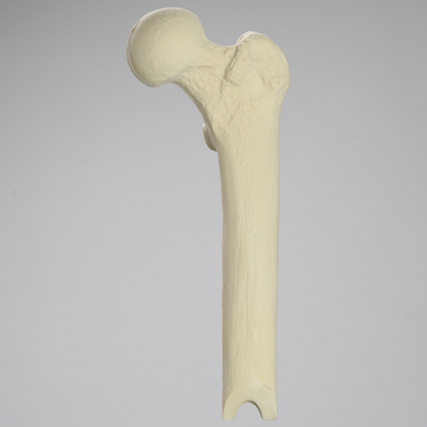 Femur with Osteotomy, Proximal, Foam Cortical Shell