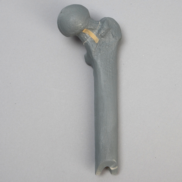 Femur with Neck Fracture, Replacement Part for #1516-39 Trainer
