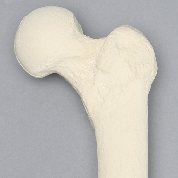 Femur with 3 PCF Cancellous, Foam Cortical