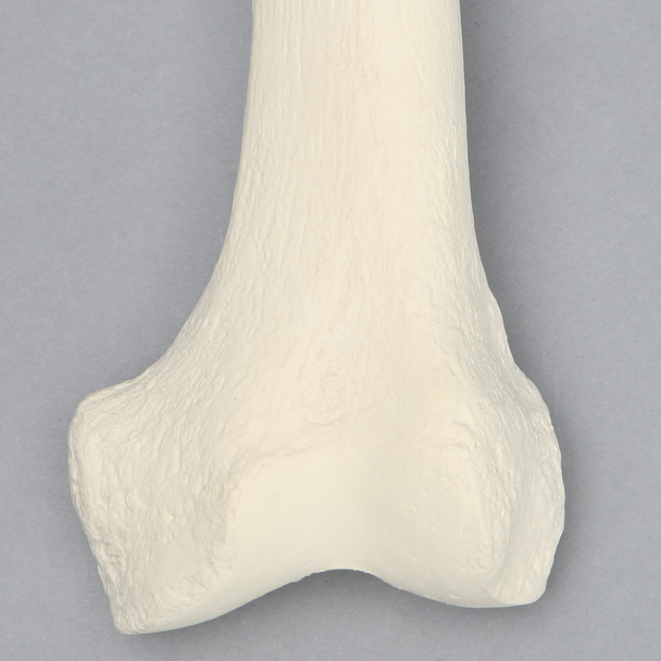 Femur with 3 PCF Cancellous, Foam Cortical