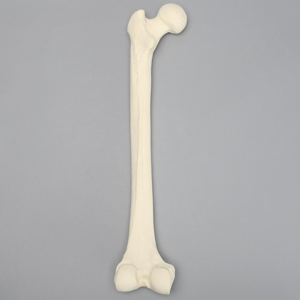Femur with 3 PCF Cancellous, Foam Cortical