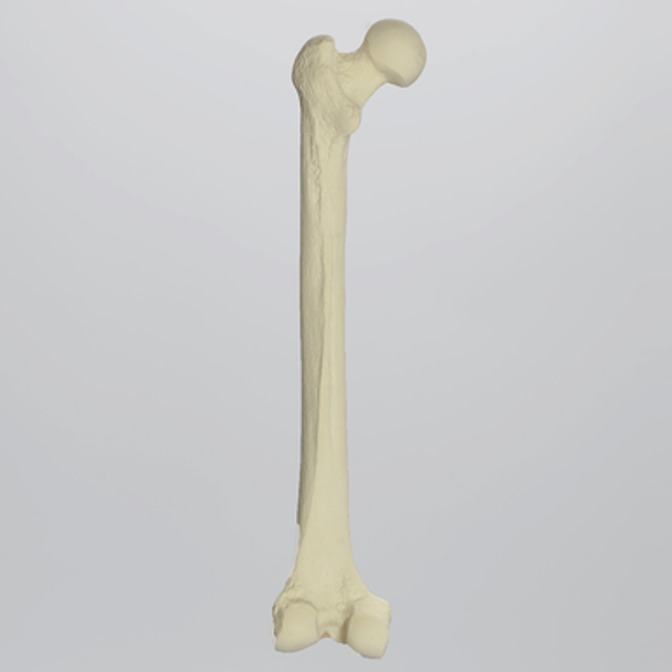 Femur with 10 mm Canal, Foam Cortical Shell, Left