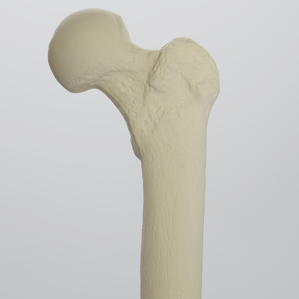 Femur with 10 mm Canal, Foam Cortical Shell, Left