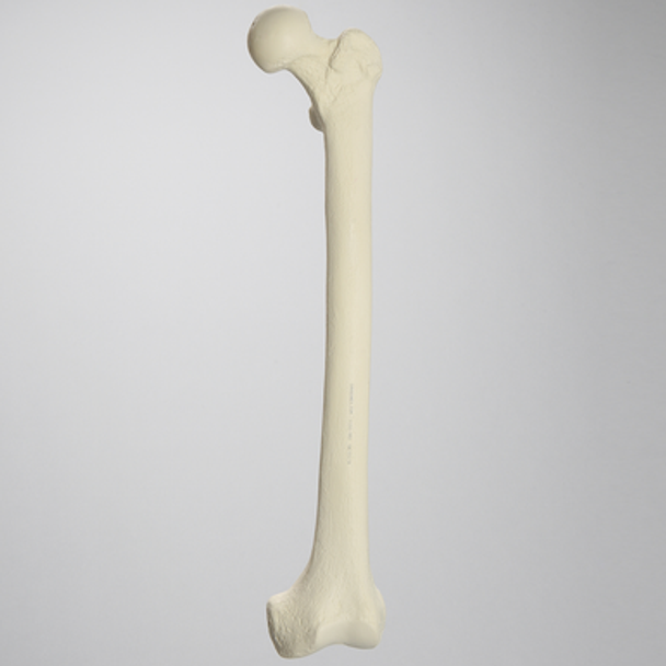Stryker Femur for Exeter Plug and Stem