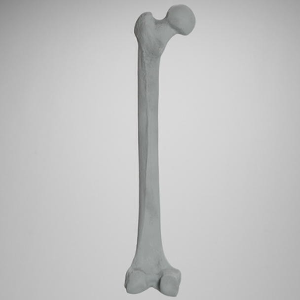 Femur, Radiopaque, Left